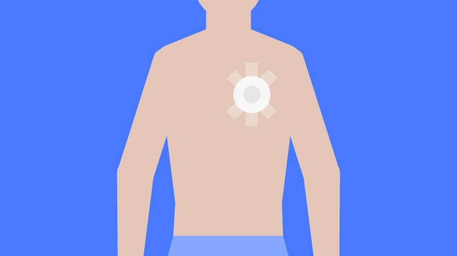 Male Torso with Magnet in Chest
